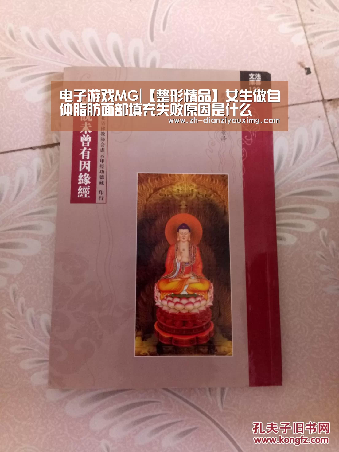 电子游戏MG|【整形精品】女生做自体脂肪面部填充失败原因是什么(图1) 电子游戏MG